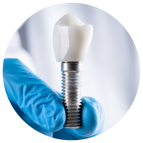 Artificial tooth Artificial tooth
