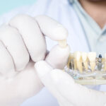 Dentist and implant model.