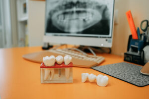 Dental research