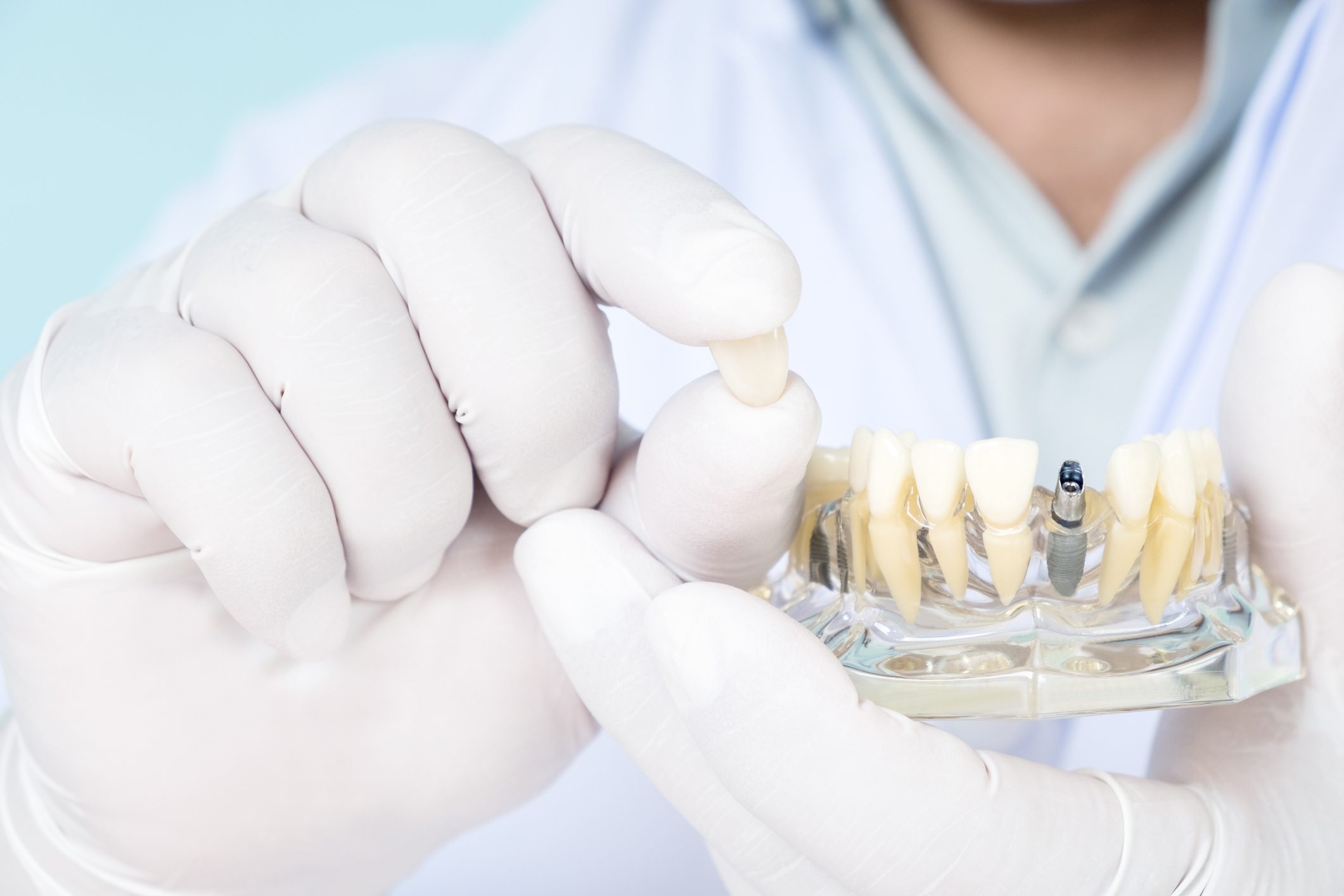 A gloved hand holds a dental crown near a dental model with artificial teeth, illustrating a tooth replacement or dental implant procedure.
