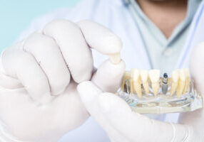 Dentist and implant model.